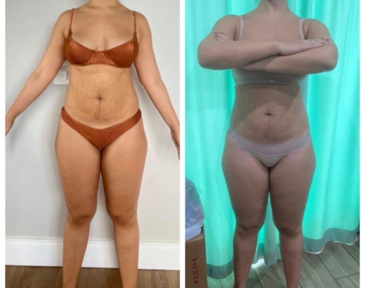 Resultado [object Object]